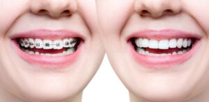 Best Orthodontics in Indirapuram